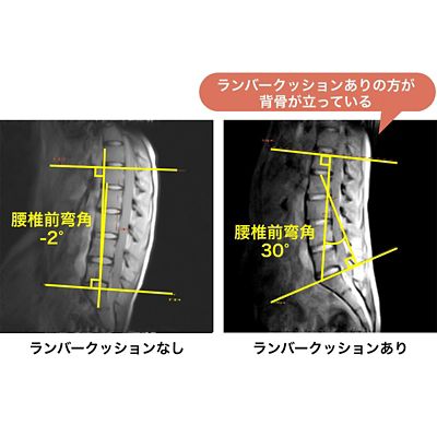 西川　Ｋｅｅｐランバークッション（腰のまくら）（ＨＧ９３１０４６５２）
